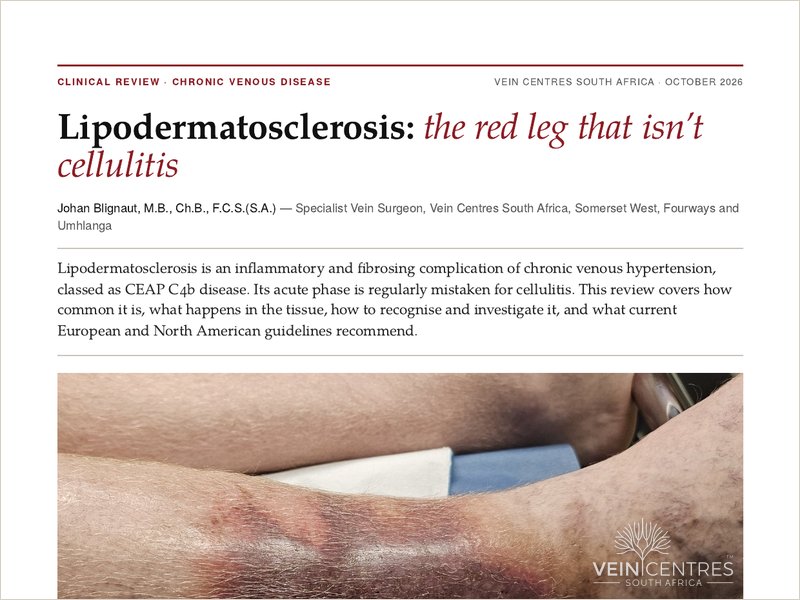 First page of the clinical review Lipodermatosclerosis: the red leg that isn’t cellulitis, showing a red-violaceous plaque above the ankle.